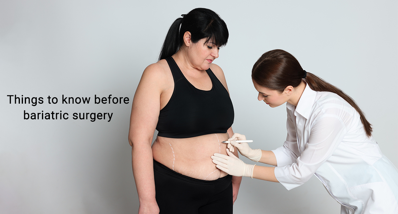 Things to know before bariatric surgery